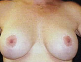 Patient # 28638 After Photo # 2